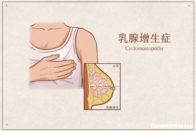 怎么治疗小叶增生乳房囊肿 小叶增生乳腺囊肿乳腺结节都有怎么办