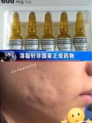 溶脂针打了多久消肿 溶脂针打了多久效果最好