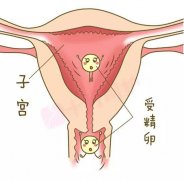 生化妊娠之后多久停止出血 生化妊娠之后多久停止出血了
