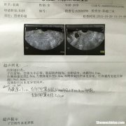 卵泡两天没长怎么回事 卵泡两天没长怎么回事啊
