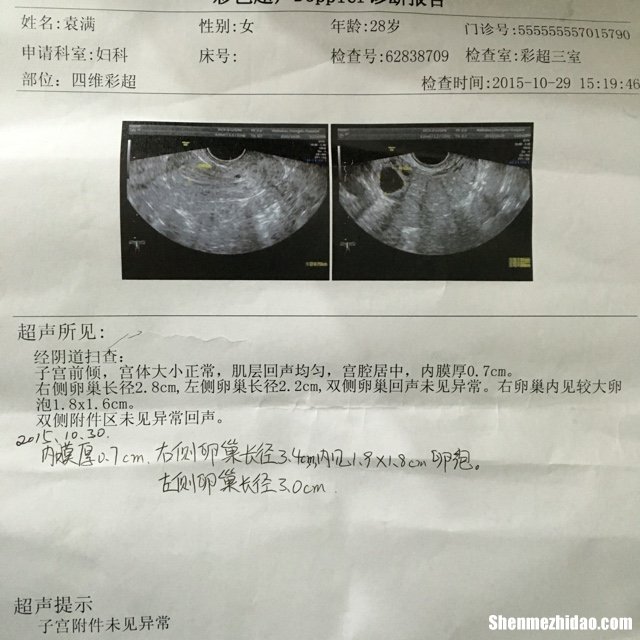 卵泡两天没长怎么回事 卵泡两天没长怎么回事啊