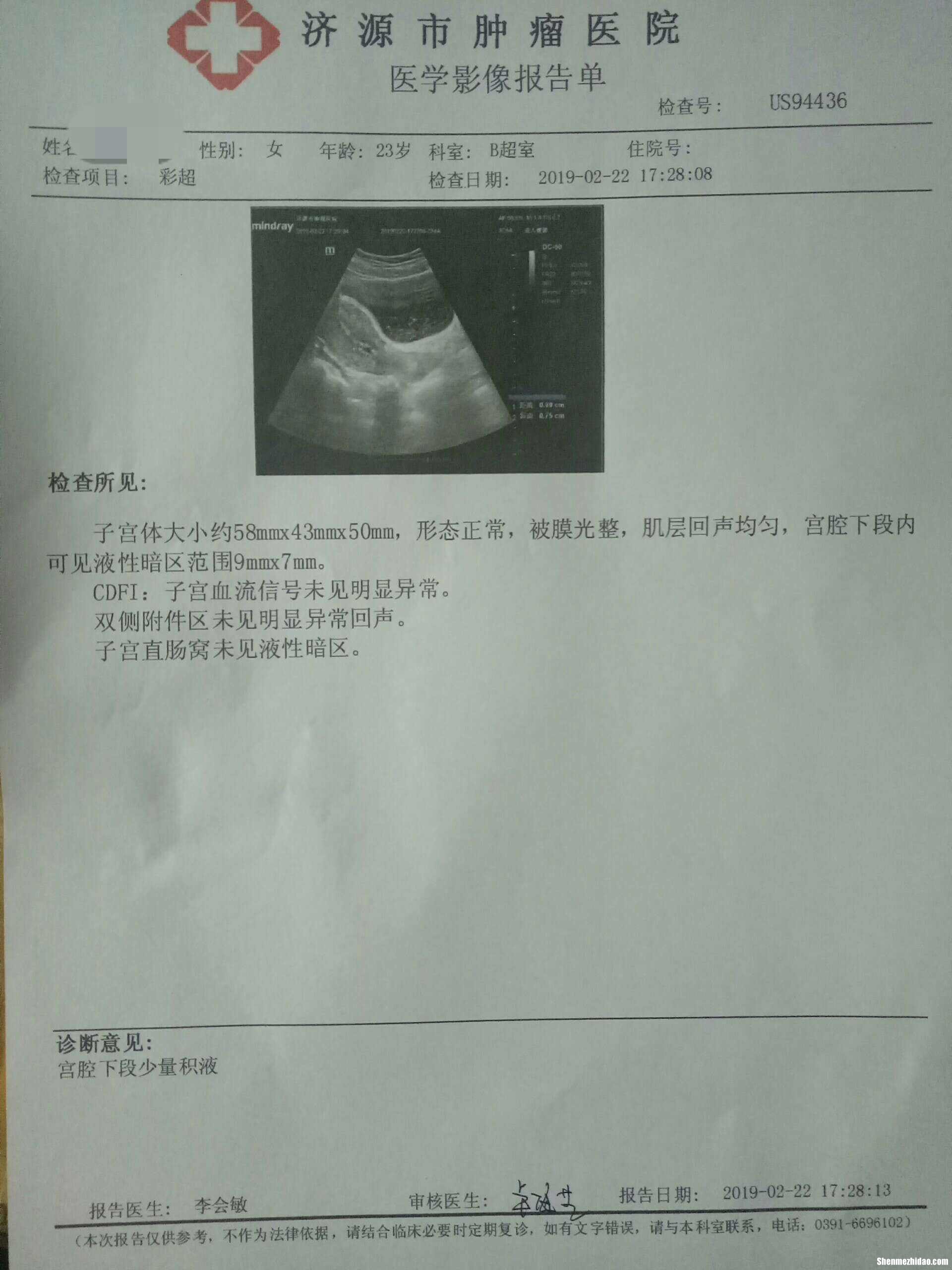 宫外孕多久容易爆血管 宫外孕多久会流血 流多久呢