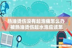热油烫伤没有起泡痛怎么办 被热油烫伤起水泡应该怎么处理