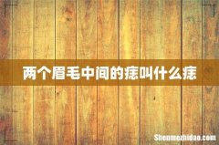 两个眉毛中间的痣叫什么痣