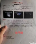 附睾炎要多久才好 附睾炎要多久才好呢