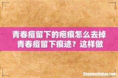 青春痘留下的疤痕怎么去掉 青春痘留下痕迹？这样做还你光滑肌肤