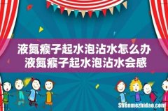 液氮瘊子起水泡沾水怎么办 液氮瘊子起水泡沾水会感染吗