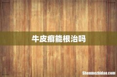 牛皮癣能根治吗