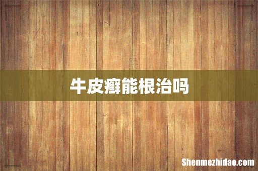 牛皮癣能根治吗
