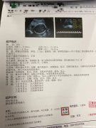 无锡虹桥医院大排畸提前多久预约 无锡虹桥医院大排畸提前多久预约啊