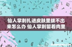 仙人掌刺扎进皮肤里拔不出来怎么办 仙人掌刺留着肉里有事吗