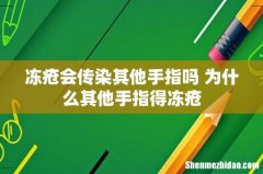 冻疮会传染其他手指吗 为什么其他手指得冻疮