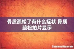 骨质疏松了有什么症状 骨质疏松拍片显示