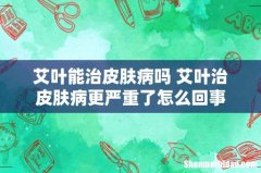 艾叶能治皮肤病吗 艾叶治皮肤病更严重了怎么回事