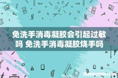 免洗手消毒凝胶会引起过敏吗 免洗手消毒凝胶烧手吗