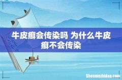 牛皮癣会传染吗 为什么牛皮癣不会传染
