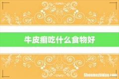 牛皮癣吃什么食物好