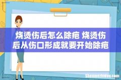 烧烫伤后怎么除疤 烧烫伤后从伤口形成就要开始除疤！