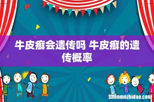 牛皮癣会遗传吗 牛皮癣的遗传概率