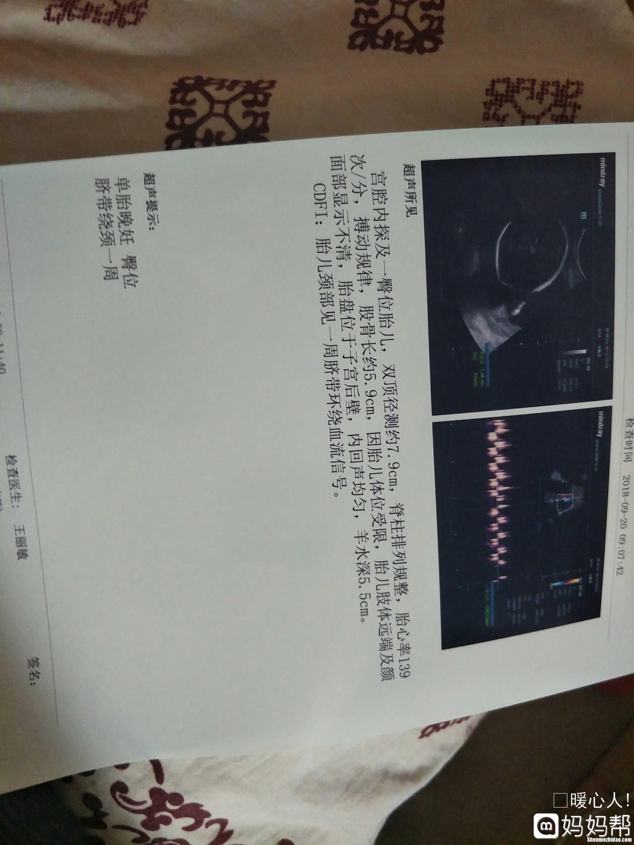 臀位见红后多久会生 臀位见红需要观察多久