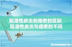 脂溢性皮炎和痤疮的区别 脂溢性皮炎与痤疮的不同
