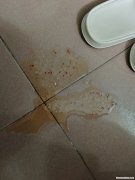 酒后吐黄水是怎么回事 酒后吐黄水有没有生命危险