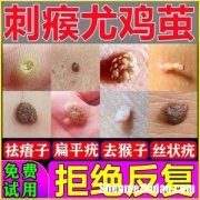 刺窝怎么治 刺窝怎么去除用什么药水
