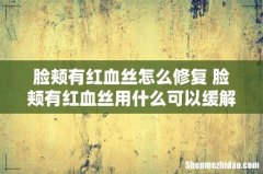 脸颊有红血丝怎么修复 脸颊有红血丝用什么可以缓解