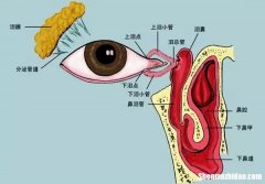 做鼻泪管要多久才恢复 做鼻泪管要多久才恢复正常