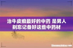 治牛皮癣最好的中药 是男人别忘记备好这些中药材
