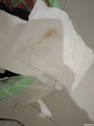 顺产后多久大便正常 顺产后多久大便一次正常