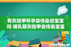 有灰指甲怀孕会传染给宝宝吗 哺乳期灰指甲会传染宝宝吗