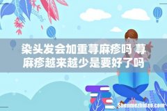 染头发会加重荨麻疹吗 荨麻疹越来越少是要好了吗
