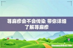 荨麻疹会不会传染 带你详细了解荨麻疹