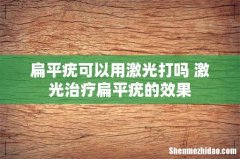 扁平疣可以用激光打吗 激光治疗扁平疣的效果