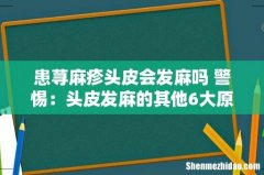 患荨麻疹头皮会发麻吗 警惕：头皮发麻的其他6大原因