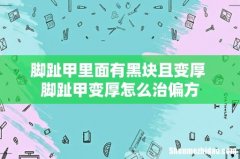 脚趾甲里面有黑块且变厚 脚趾甲变厚怎么治偏方
