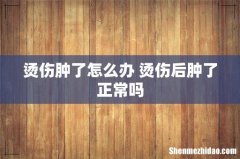 烫伤肿了怎么办 烫伤后肿了正常吗