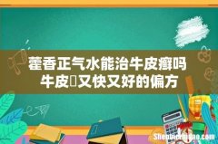 藿香正气水能治牛皮癣吗 牛皮癬又快又好的偏方