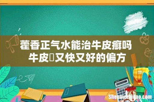 藿香正气水能治牛皮癣吗 牛皮癬又快又好的偏方