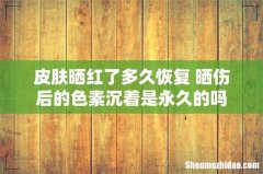 皮肤晒红了多久恢复 晒伤后的色素沉着是永久的吗
