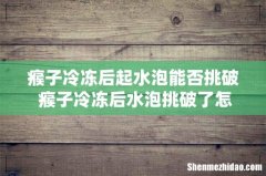 瘊子冷冻后起水泡能否挑破 瘊子冷冻后水泡挑破了怎么办