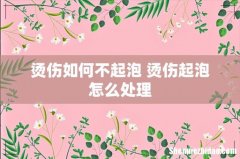 烫伤如何不起泡 烫伤起泡怎么处理