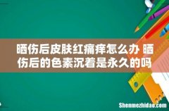 晒伤后皮肤红痛痒怎么办 晒伤后的色素沉着是永久的吗