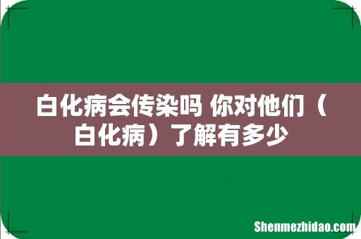 白化病 白化病会传染吗 你对他们了解有多少