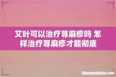 艾叶可以治疗荨麻疹吗 怎样治疗荨麻疹才能彻底
