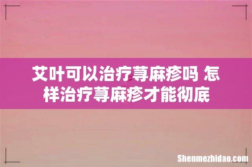 艾叶可以治疗荨麻疹吗 怎样治疗荨麻疹才能彻底