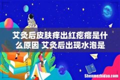 艾灸后皮肤痒出红疙瘩是什么原因 艾灸后出现水泡是什么原因