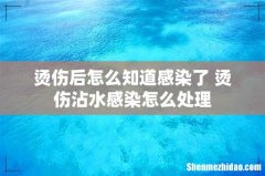 烫伤后怎么知道感染了 烫伤沾水感染怎么处理