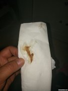 怀孕多久分泌物增多 怀孕多久分泌物增多会流产